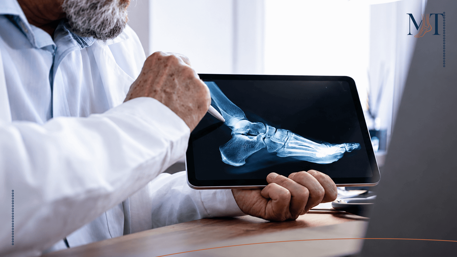 Is Bunion Hereditary?