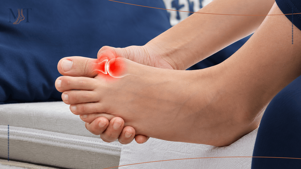 Myth: Bunion Is Just a Cosmetic Problem