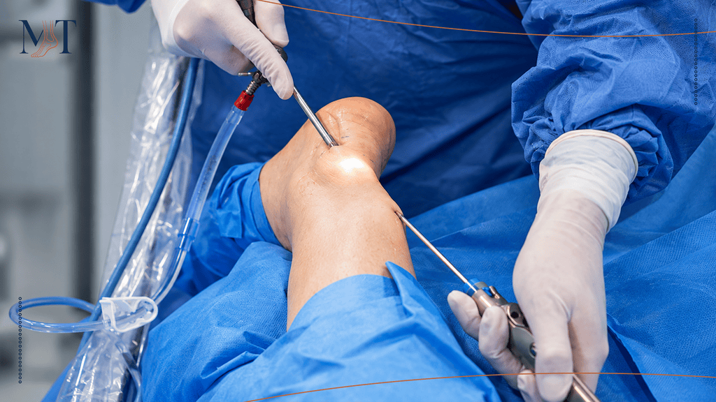 Ankle Arthroscopy — Precision Diagnosis and Treatment