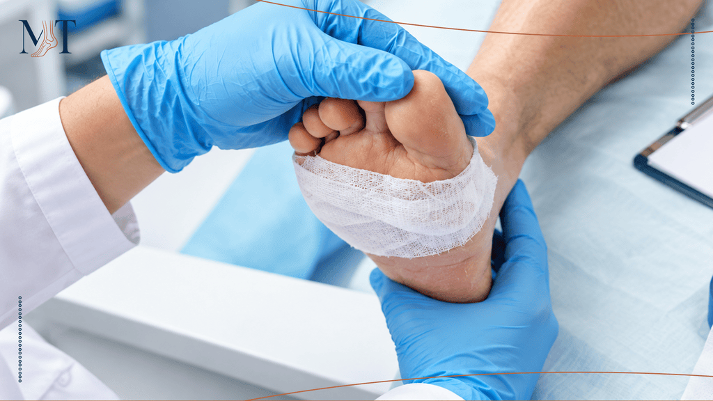 Can a Bunion Come Back After Surgery?
