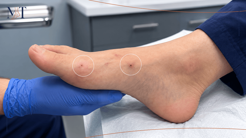 How Small Is the Incision in MIS Surgery?