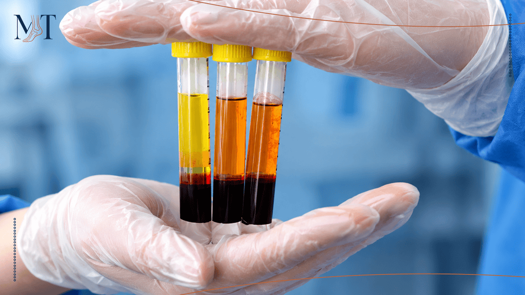 The Role of Regenerative Medicine (PRP) in Recovery